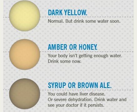 urine color part 2