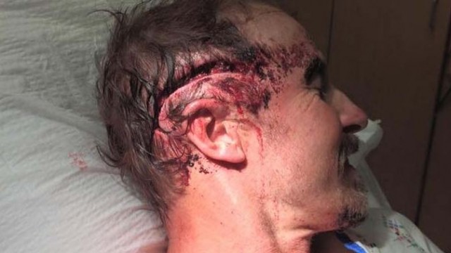 bear attack wound