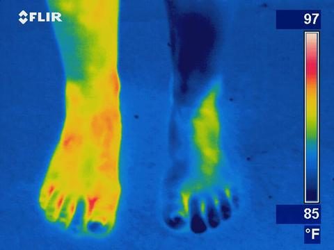 Blood flow circulation problem