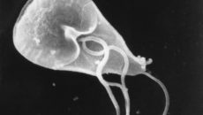 Giardia Lamblia (Beaver Fever)