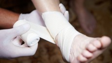 bandaging up a foot