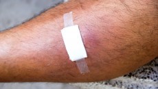 bandage on a leg