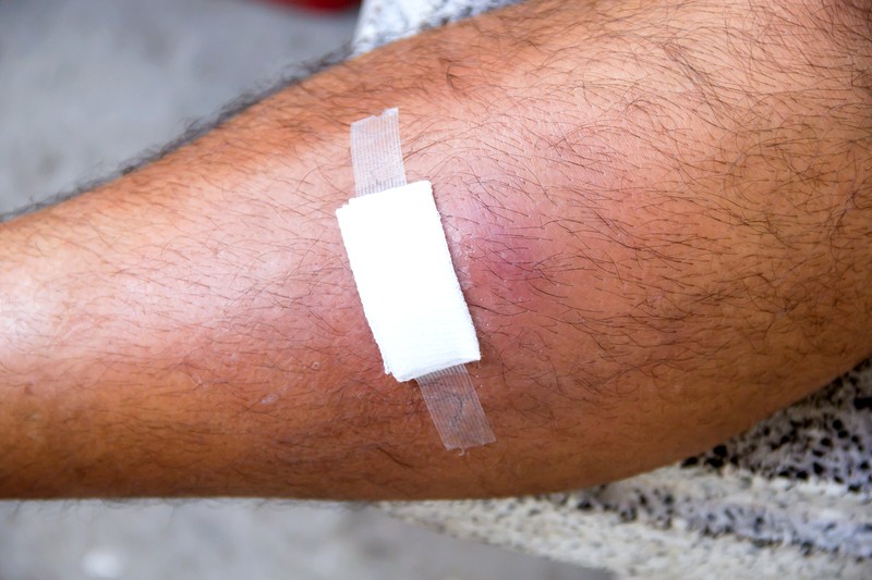 bandage on a leg