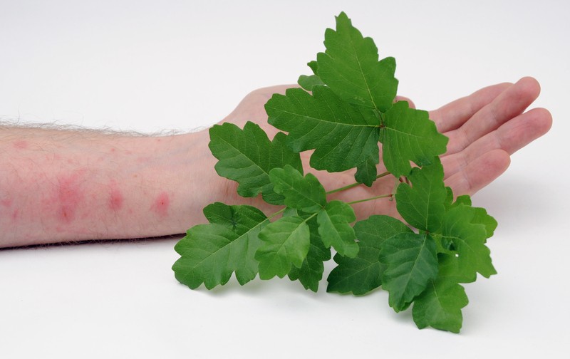 poison ivy rash