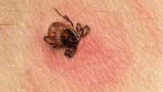 tick on skin