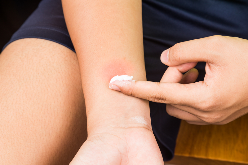 baking soda on itchy skin